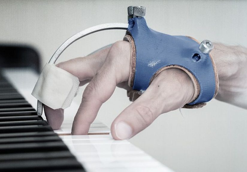 Dystonia: Symptoms, Types, Causes, and How to Treat It