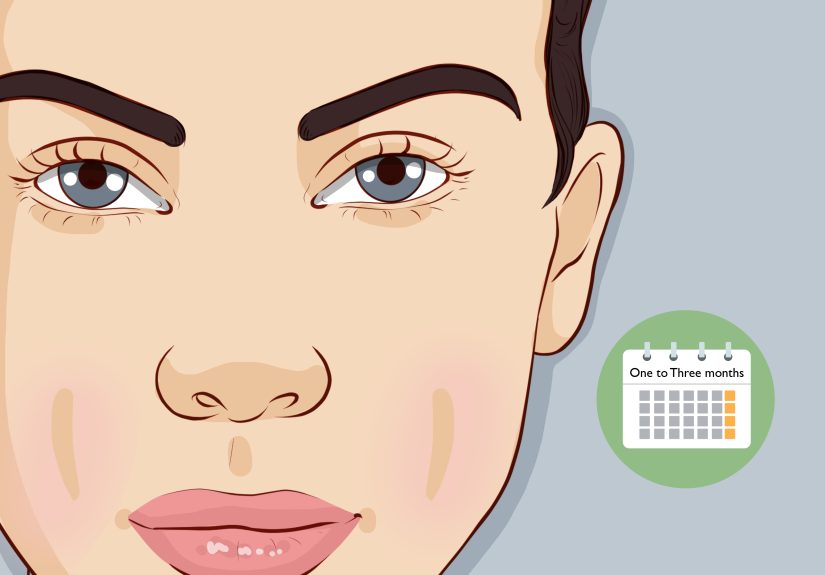 3 Ways to Get Dimples Naturally