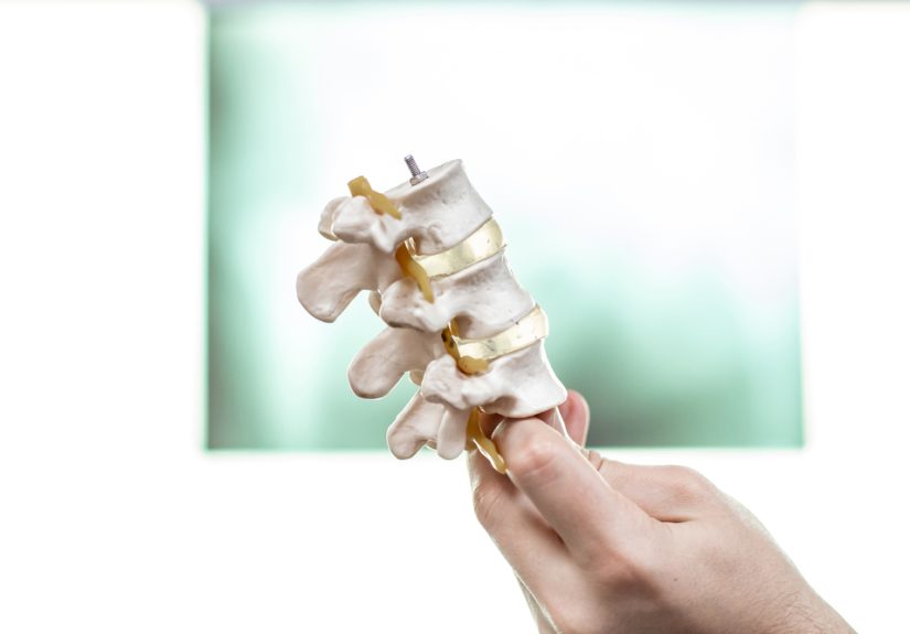 5 Questions to Ask Before You Have Back Surgery