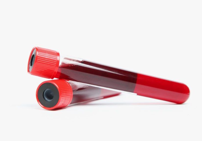 Anti-Smooth Muscle Antibody: Purpose, Risks, and Results