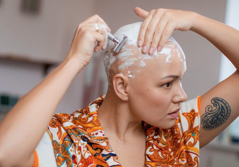 Baldness Gene: How Genetics Influence Hair Loss