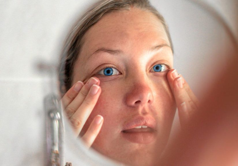 Bulging Eyes: Causes, Diagnosis, and Treatments