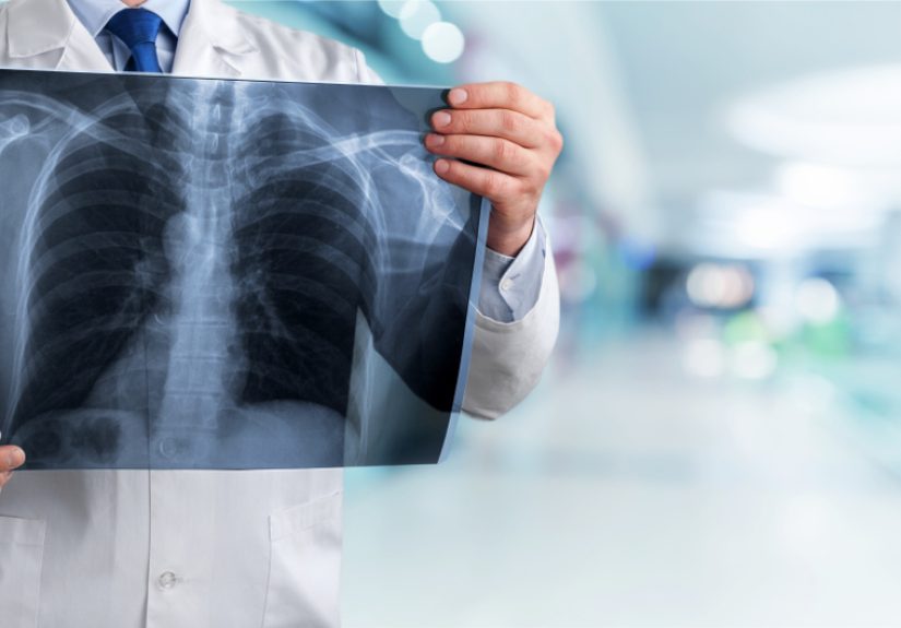 How a Radiology Trick Can Surprisingly Help Your Finances