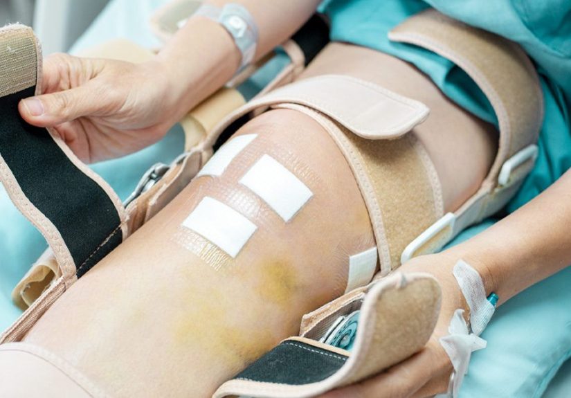 Knee Replacement Infection: Treatment, Risks, and Prevention