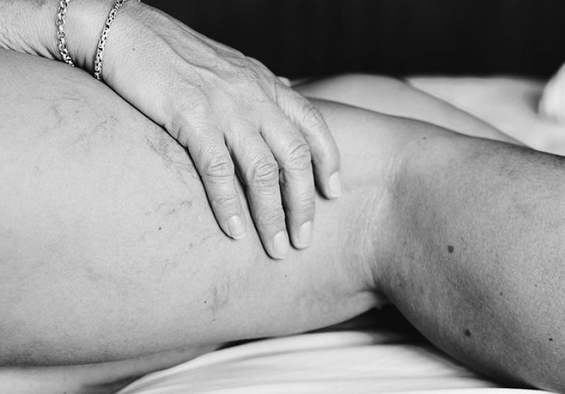 Muscle atrophy: Causes, symptoms, and treatments