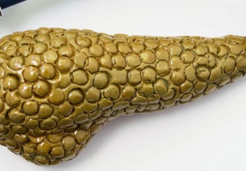 Necrotizing pancreatitis: Definition, symptoms, and treatment