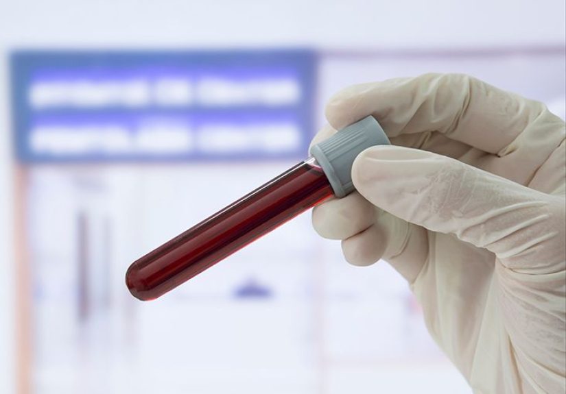 Serum Hemoglobin Test: Uses, Procedures, and Risks