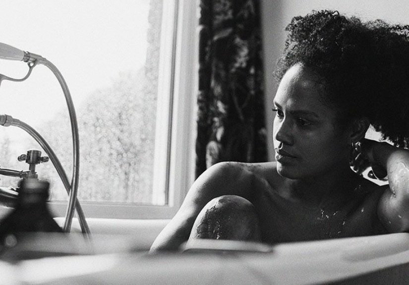 Shingles vs. herpes: How to tell the difference