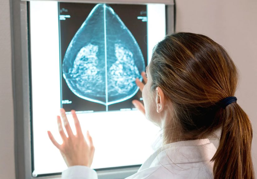 Treatment Factors for HER2-Positive Breast Cancer