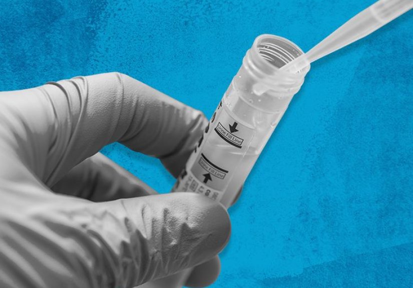 Trichomoniasis symptoms, test, and diagnosis: What to know