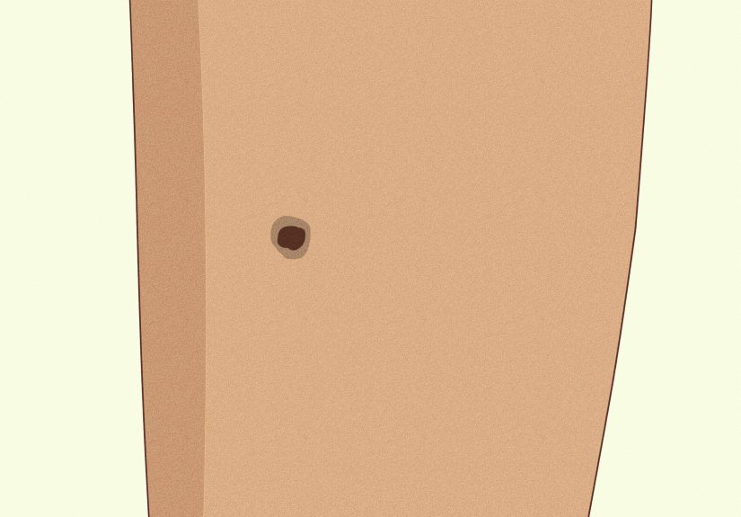 13 Common Causes Behind Itchy Legs (and How to Treat Itchiness)