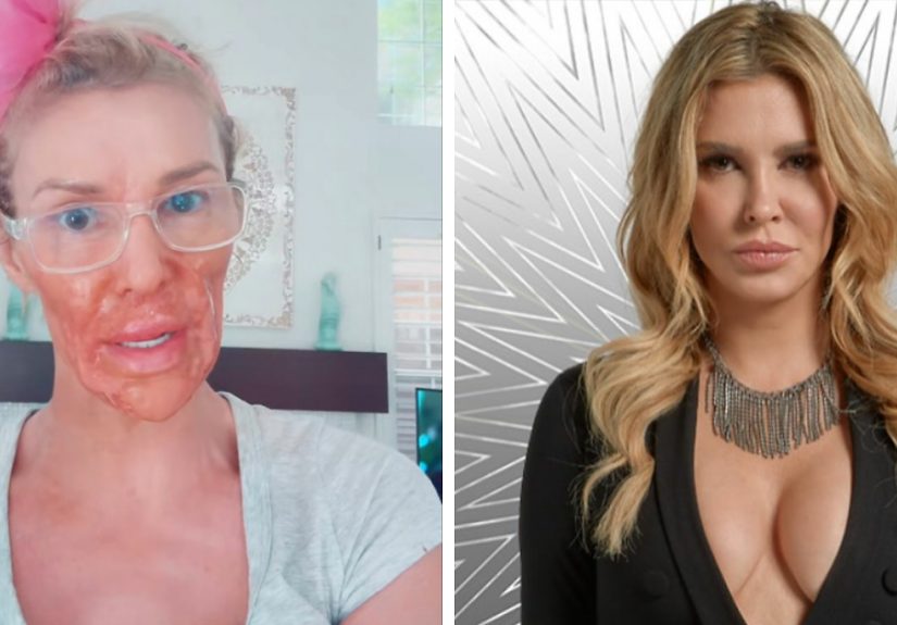 Brandi Glanville Reveals New Smile After $130K Health Battle And Face-Disfiguring Parasite