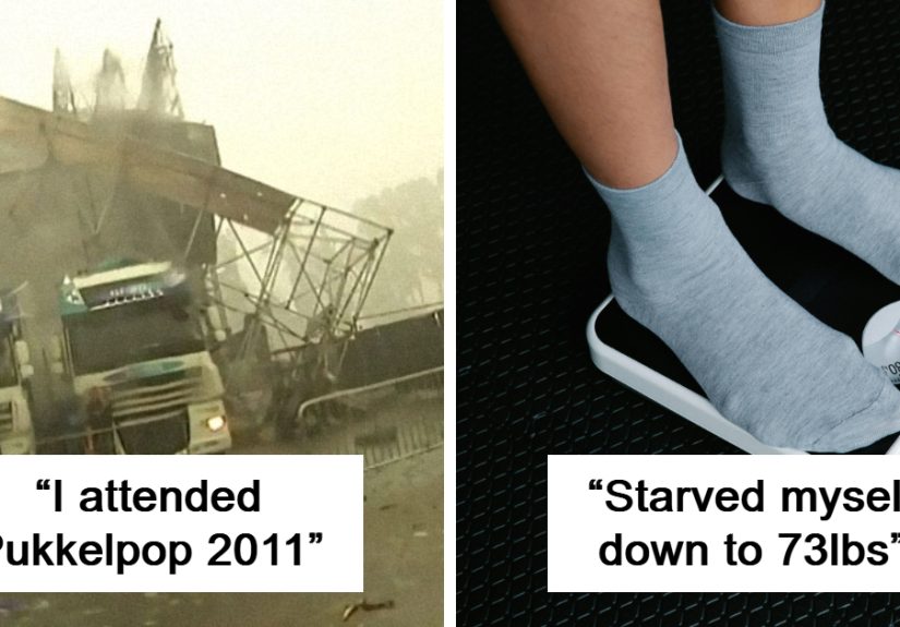 “Doctor Was Surprised I Was Alive”: 30 Incredibly Lucky People That Survived Against All Odds