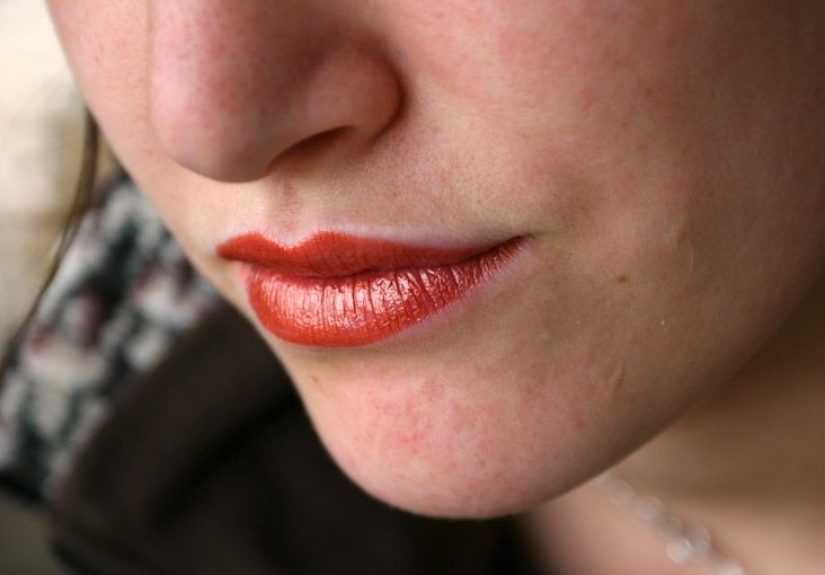 HIV Mouth Sores: What They Look Like and How to Treat Them