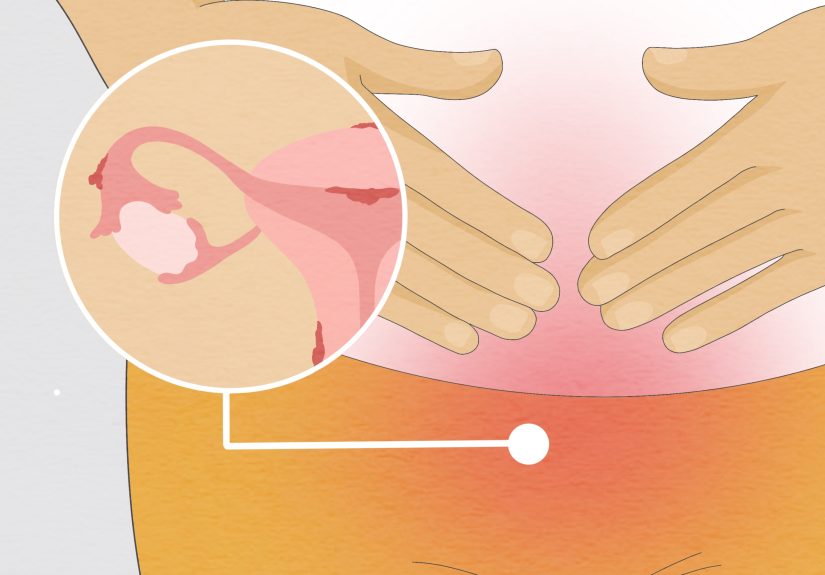 How to Get Rid of Bum Cramps on Period and Why It Happens