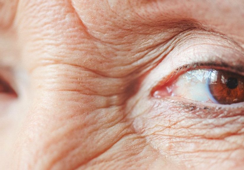 Red Rings Around Eyes: Lids, Sockets, Toddler, Symptoms, and More