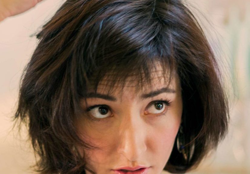 Seborrheic dermatitis hair loss: Causes and treatment