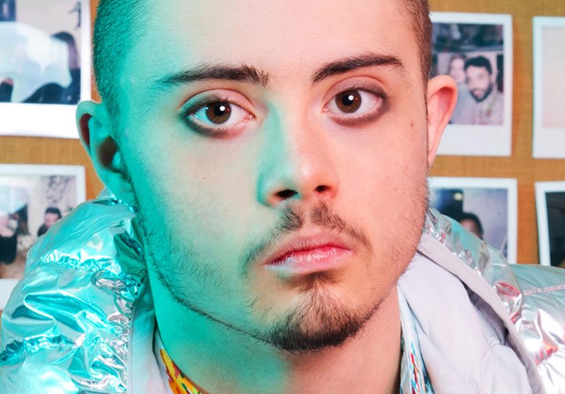 ‘The Radical Beauty Project’ Challenges The Way We See People With Down’s Syndrome By Showing Their Modeling Skills (Zebedee Management)