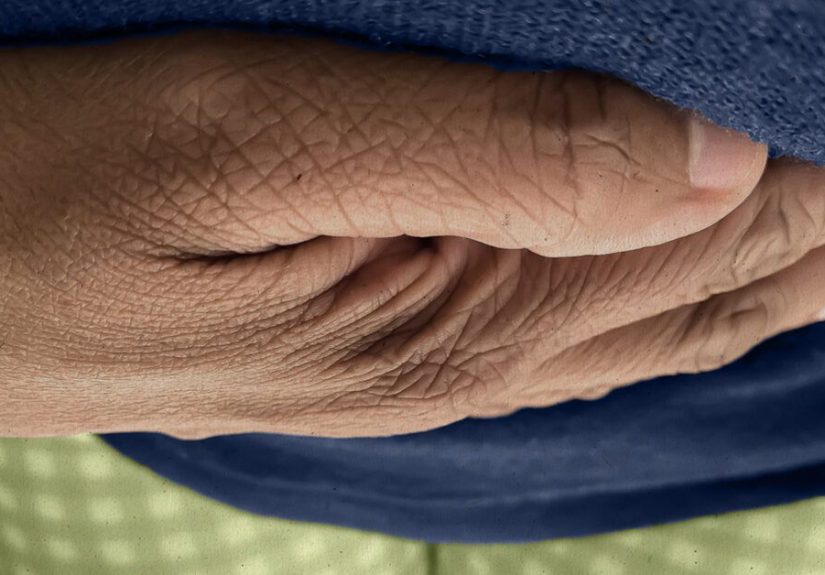 Urinary tract infection (UTI) tests: At home and doctors