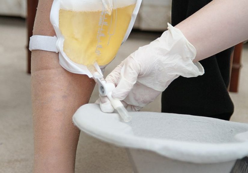 Urologic Diseases: Overviews & Tips