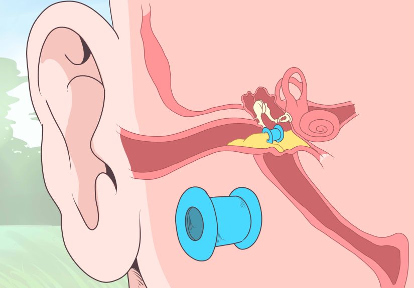 3 Ways to Tell if You Have an Ear Infection