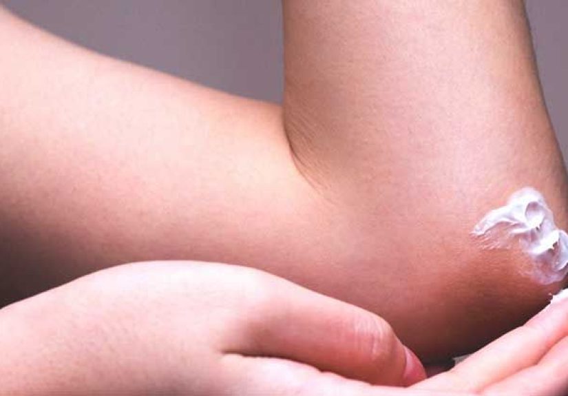 Dry Elbows: Remedies, Causes, and More