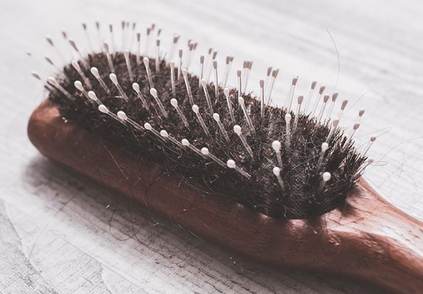 Hair loss after weight loss: Causes, risks, and prevention