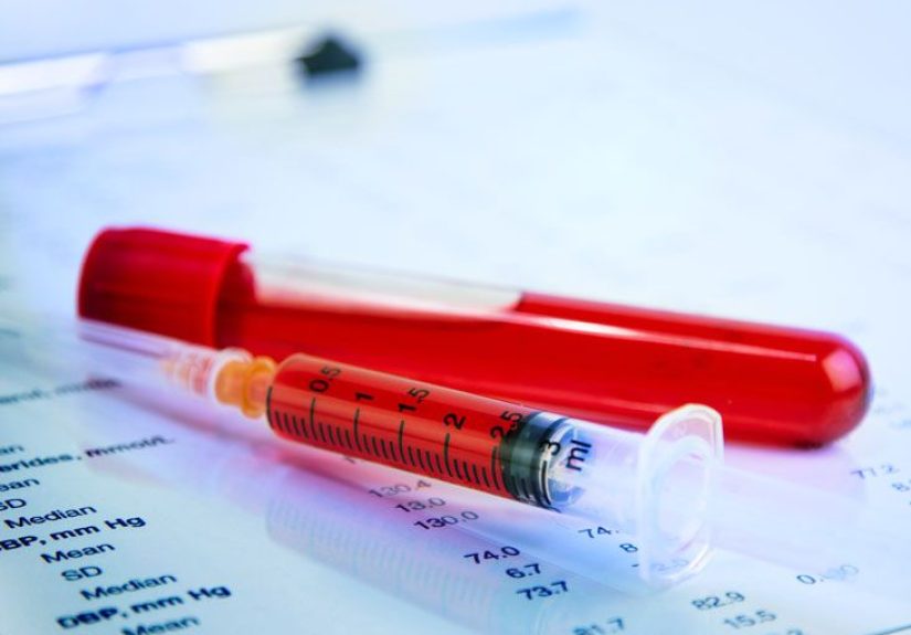 Hemoglobin Electrophoresis: Purpose, Procedure, and Results