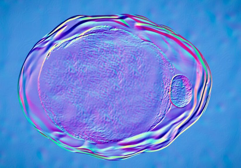 How Leptin May Contribute to Psoriasis