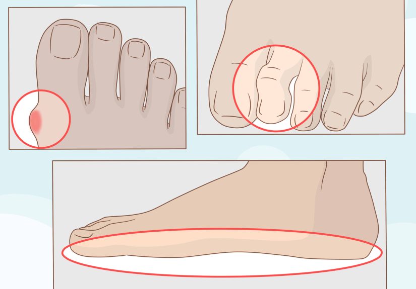 How to Get Healthy, Clean and Good Looking Feet