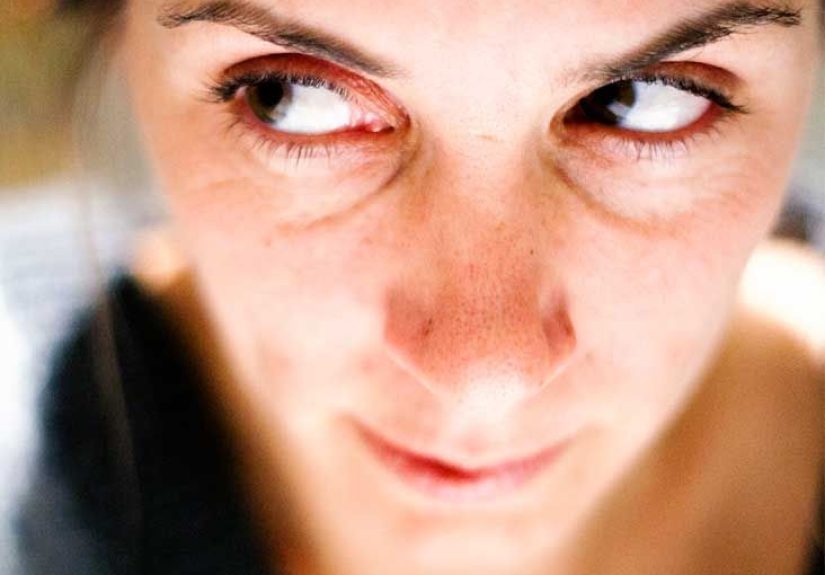 Raccoon Eyes: Basilar Skull Fracture and Treatment