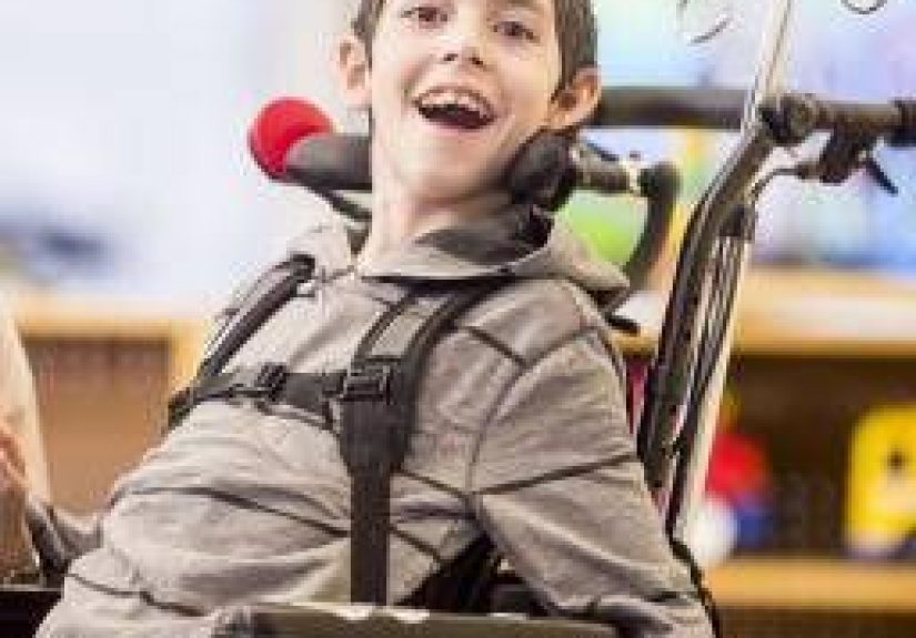 Spinal muscular atrophy (SMA): Types, symptoms, and treatment