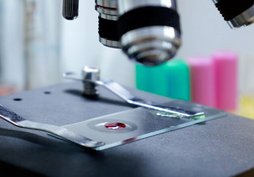 Types of Myelodysplastic Syndromes