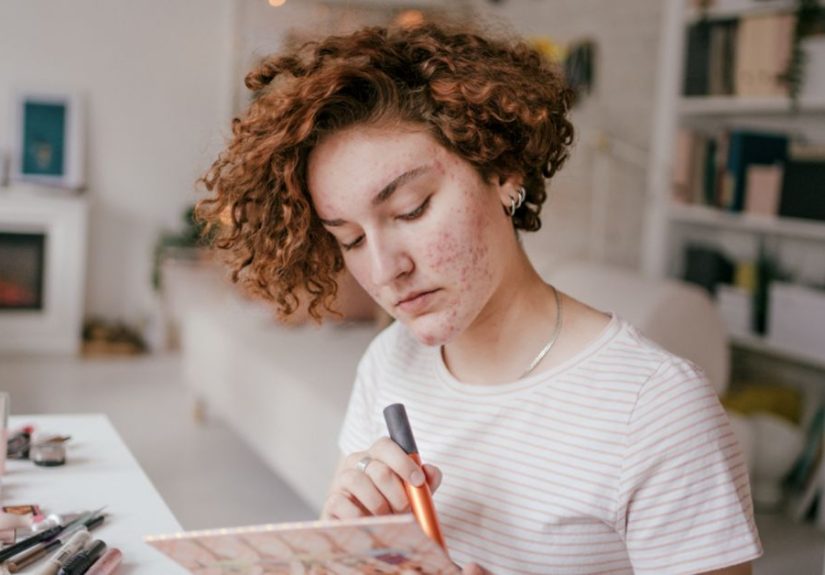 Why Am I Breaking Out? Reasons, Explanations, Solutions for Breakouts