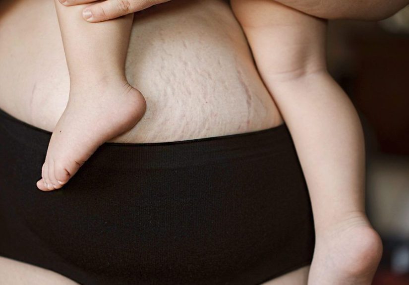 8 Best Postpartum Underwear