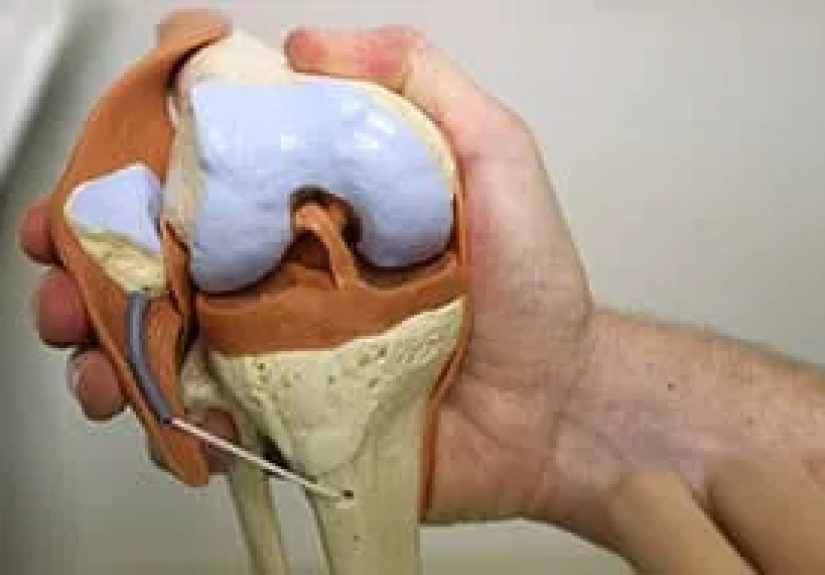 Arthroscopy for Knee Pain
