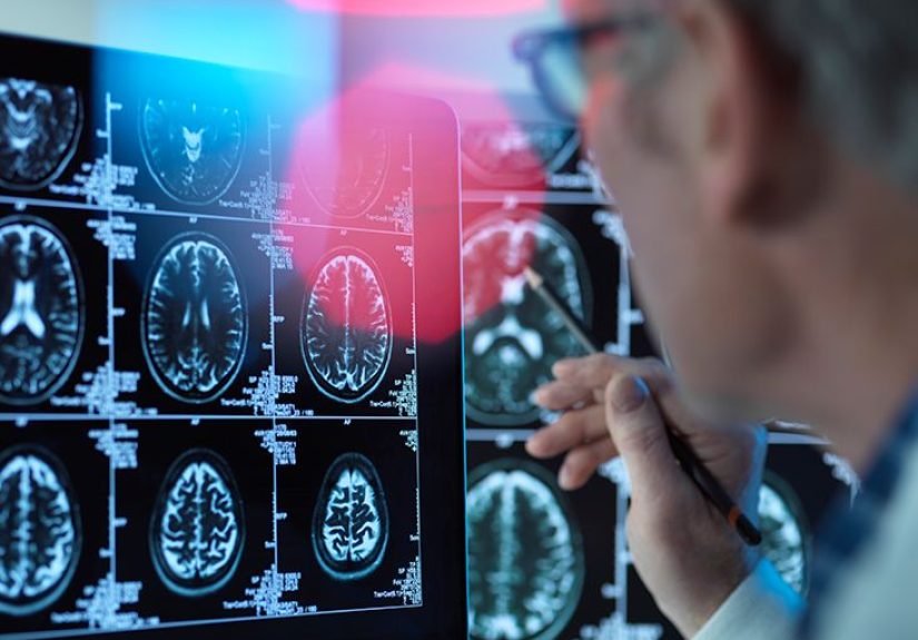 Cerebrum: Definition, diagram, function, and more