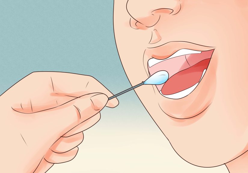 How to Diagnose Ehlers-Danlos Syndrome: Symptoms & Testing