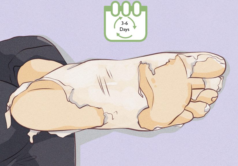 How to Use an Exfoliating Foot Peel: 10 Steps