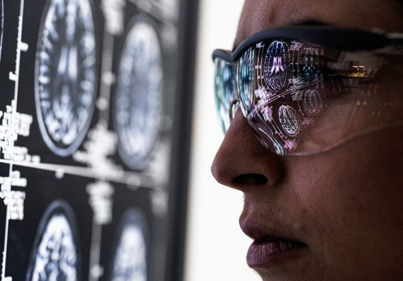 What to Know About Wernicke's Aphasia